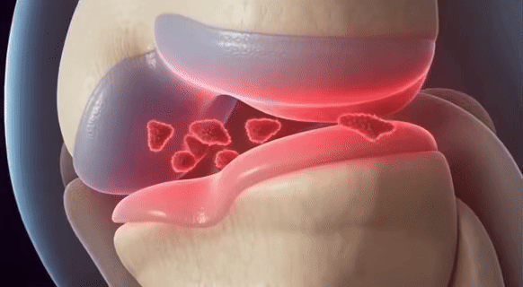 <strong>ACTIVATE</strong>