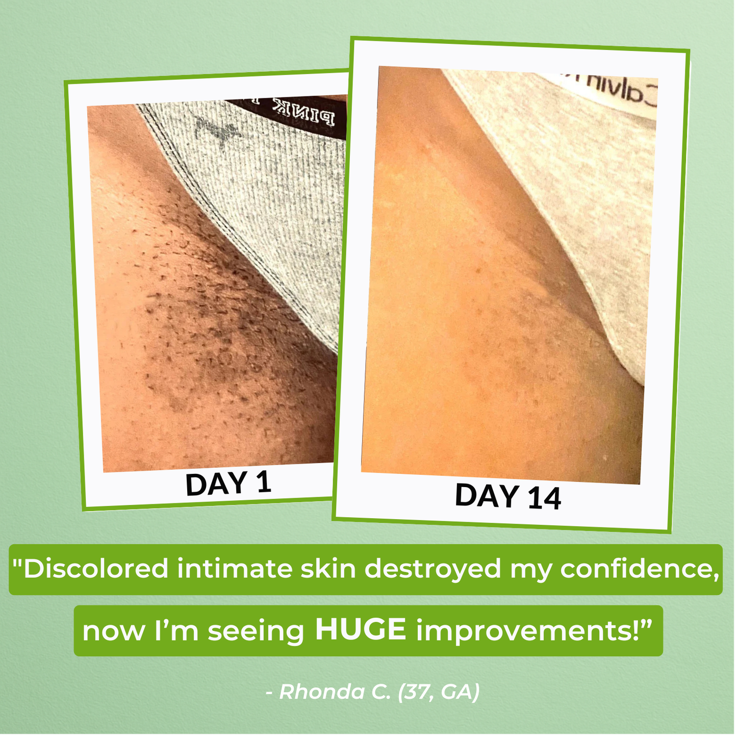 JIYU Korean Peach Bleach Toner Pads (100 Pads) | Early Access Black Friday Sale