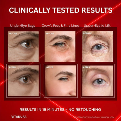 Instant Eye Bag Eraser | Early Access Black Friday Sale