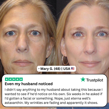 Astaxanthin Softgels for Wrinkles