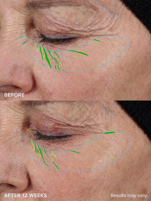 Needle-Free Growth Factor Serum | Early Access Black Friday Sale