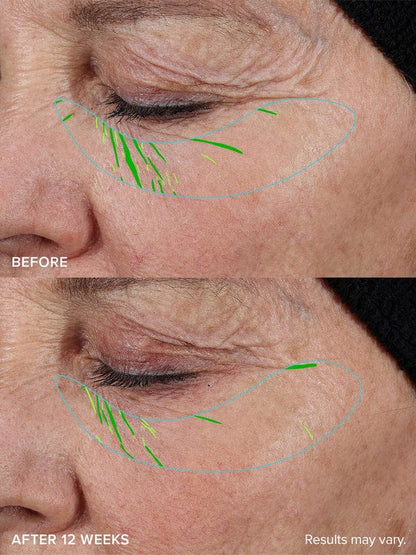 Needle-Free Growth Factor Serum | Early Access Black Friday Sale