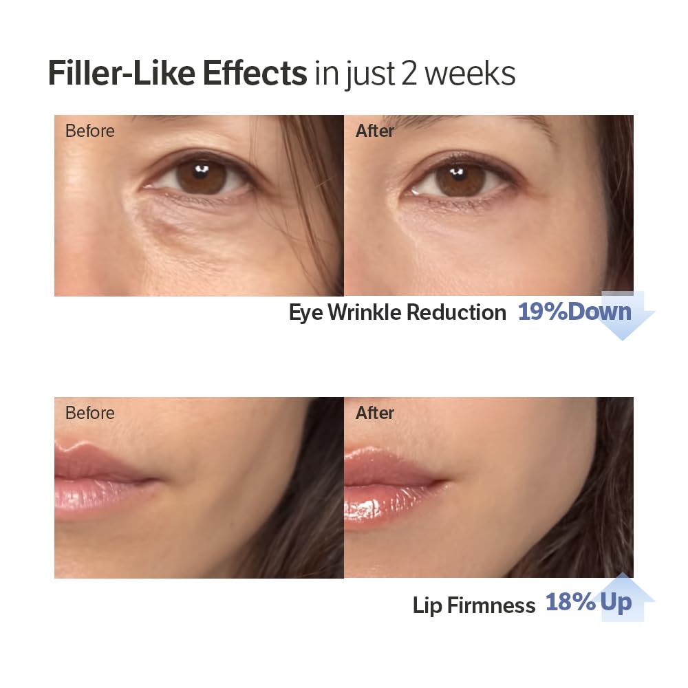 Volufiline-Infused Korean Collagen Serum | Early Access Black Friday Sale