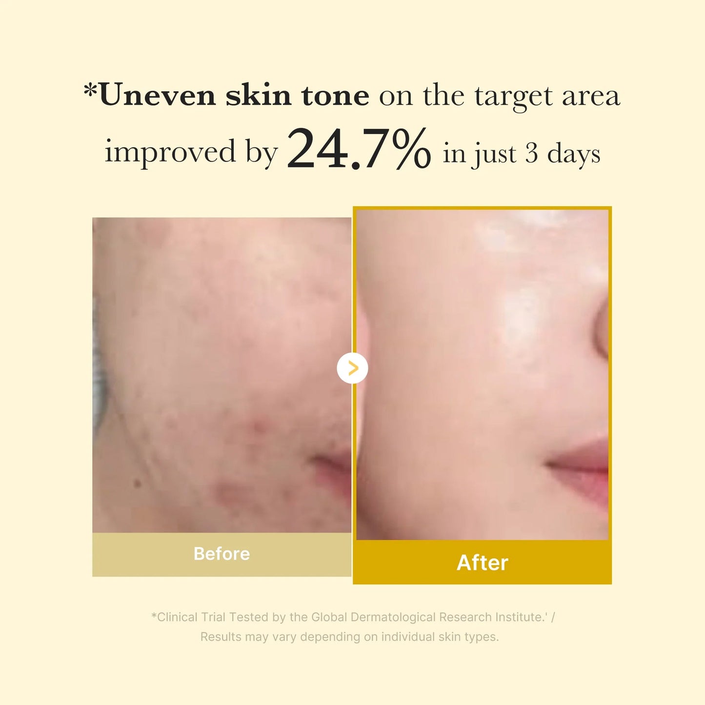 Kojic Acid Turmeric Night Wrapping Mask | Early Access Black Friday Sale
