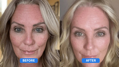 Award Winning Anti-Wrinkle Cream | Early Access Black Friday Sale