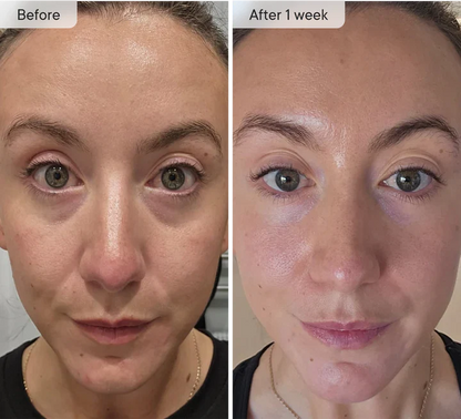 Micro-Infusion Targeted Patches | Early Access Black Friday Sale