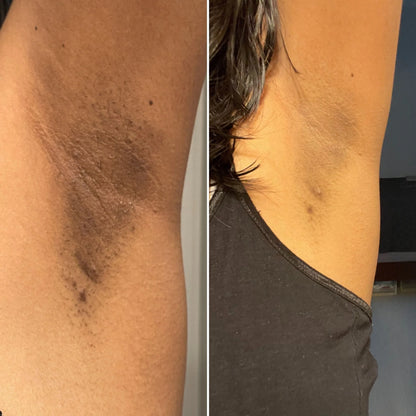 JIYU Korean Peach Bleach Toner Pads (100 Pads) | Early Access Black Friday Sale