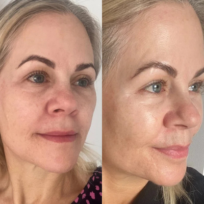 Silk Lifting Peptide | Early Access Black Friday Sale