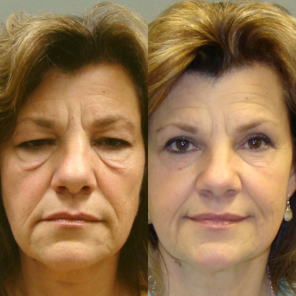 Silk Lifting Peptide | Early Access Black Friday Sale