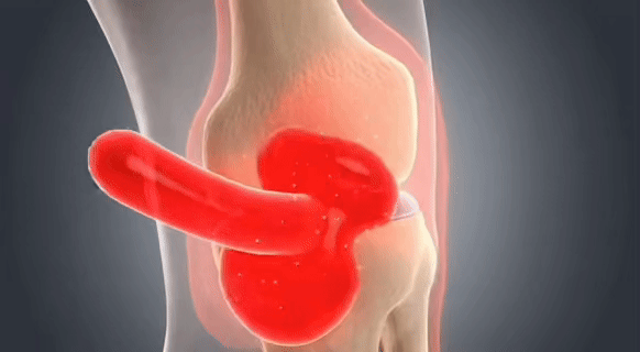 <strong>CALM</strong>