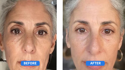 Award Winning Anti-Wrinkle Cream | Early Access Black Friday Sale