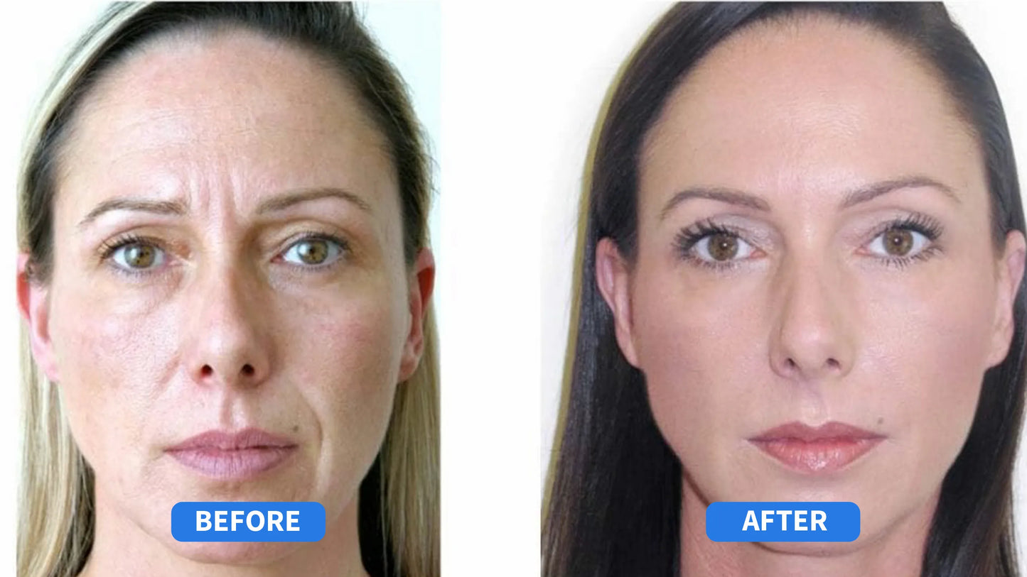 Award Winning Anti-Wrinkle Cream | Early Access Black Friday Sale