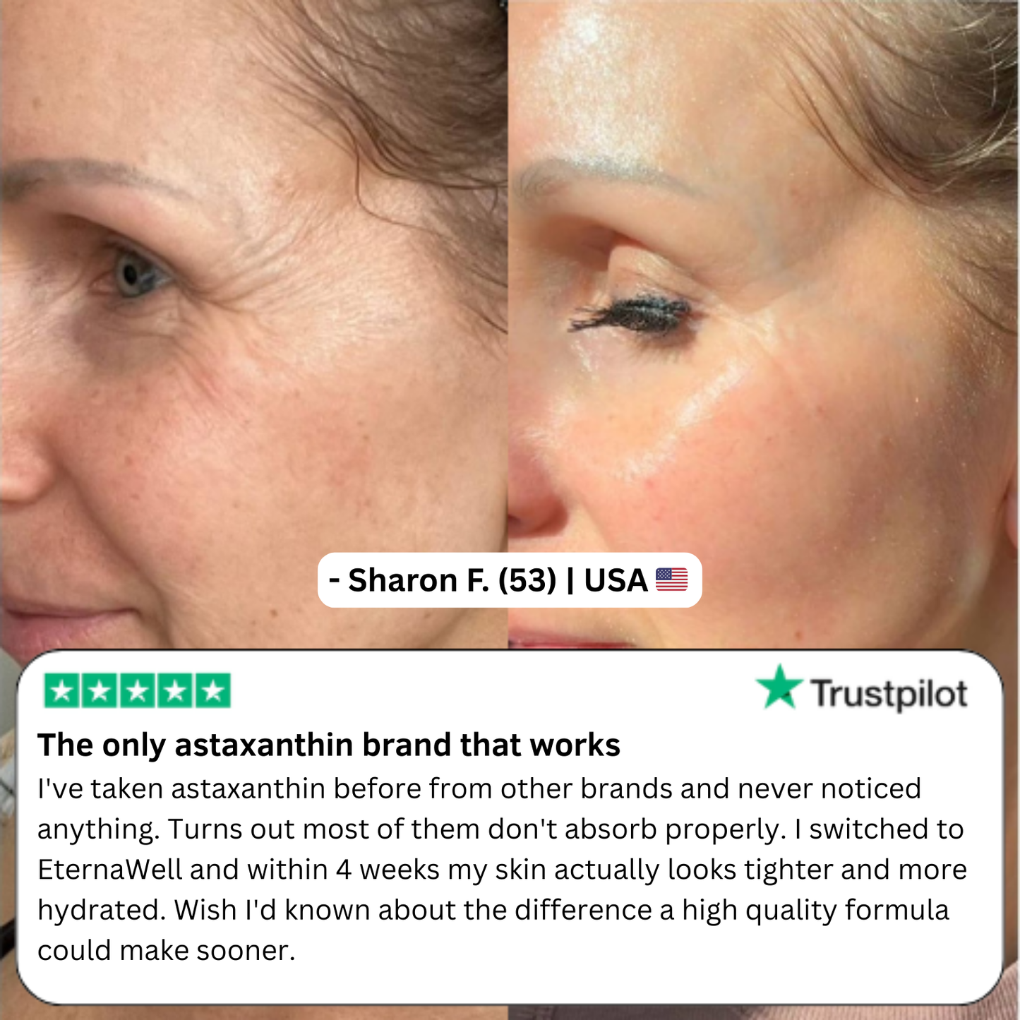 Astaxanthin Softgels for Wrinkles