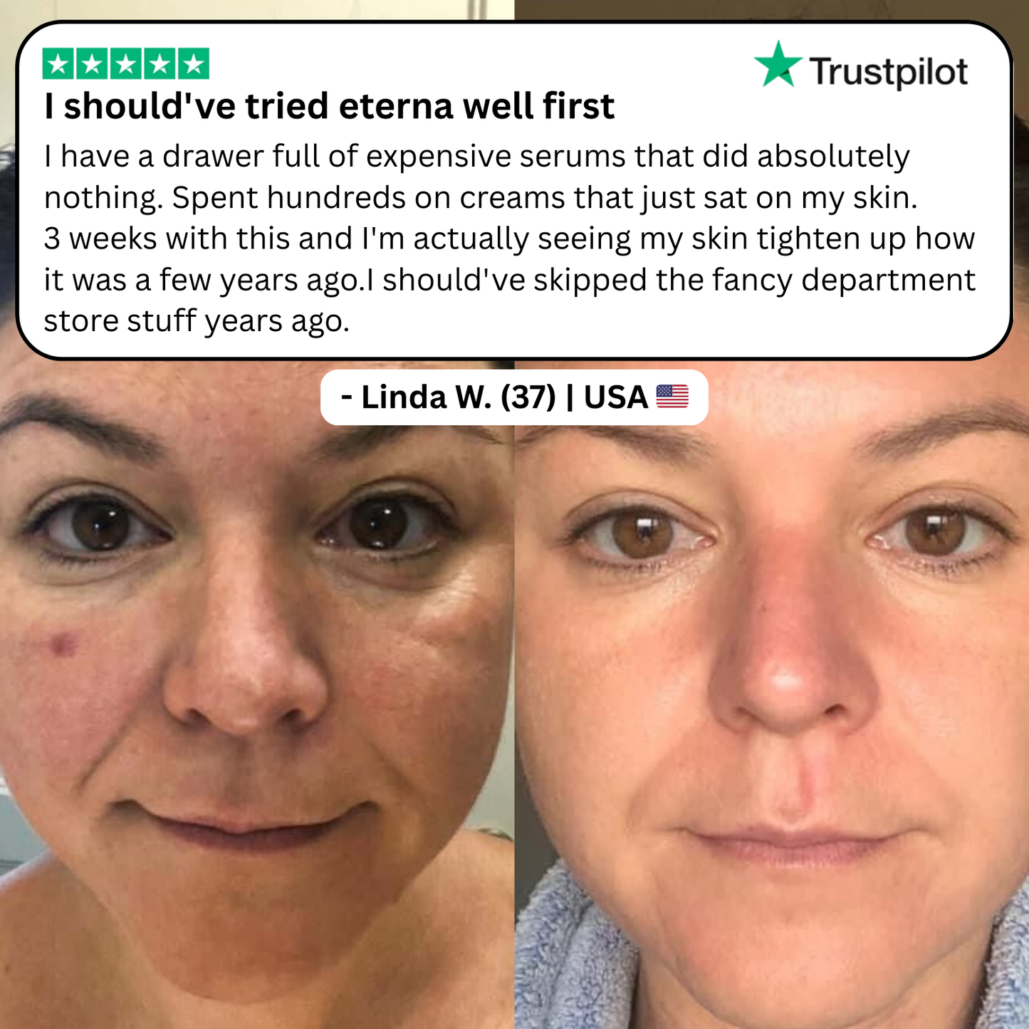 Astaxanthin Softgels for Wrinkles