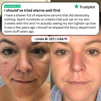 Astaxanthin Softgels for Wrinkles