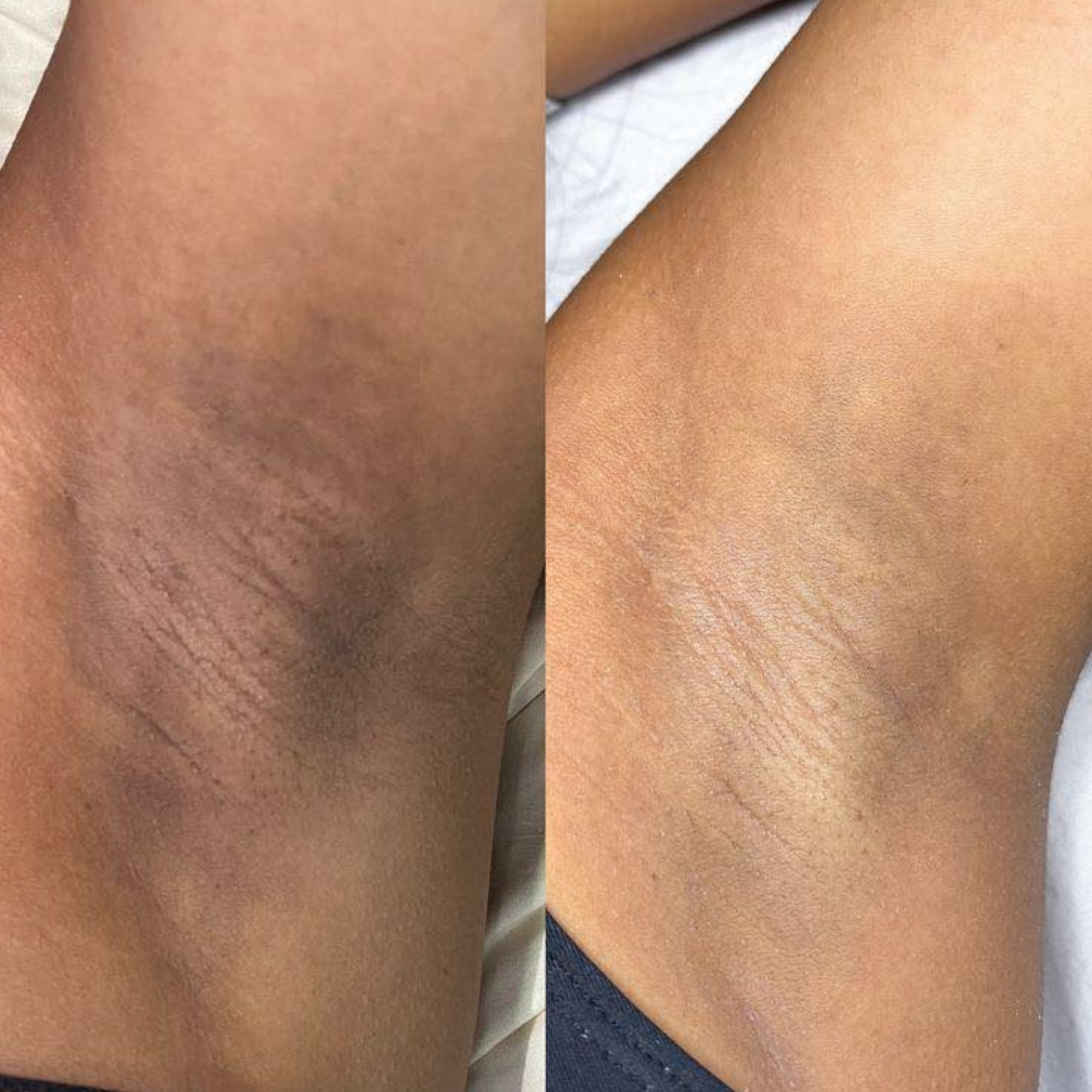 JIYU Korean Peach Bleach Toner Pads (100 Pads) | Early Access Black Friday Sale