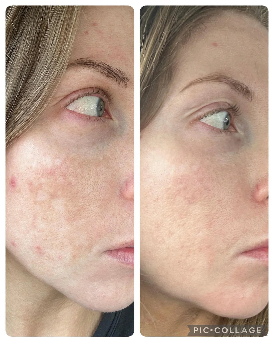 Kojic Acid Turmeric Night Wrapping Mask | Early Access Black Friday Sale