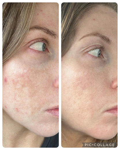 Kojic Acid Turmeric Night Wrapping Mask | Early Access Black Friday Sale