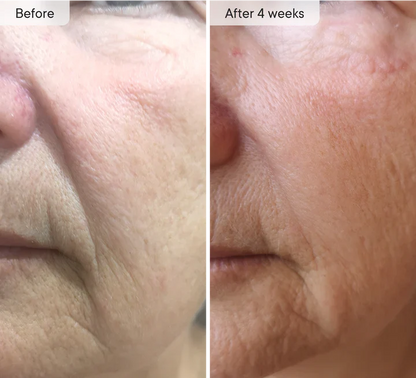 Micro-Infusion Targeted Patches | Early Access Black Friday Sale