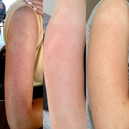 Hypochlorous Acid Peel Shot Duo For Face & Body | Early Access Black Friday Sale