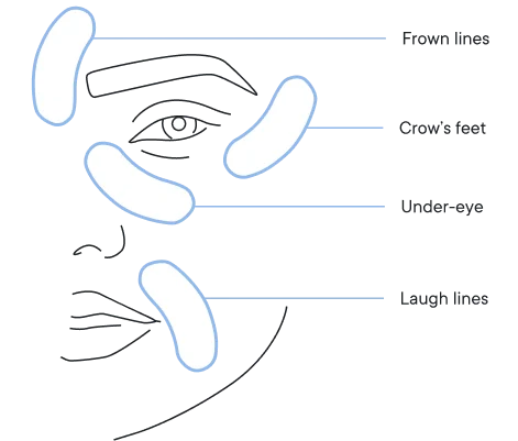 Micro-Infusion Targeted Patches | Early Access Black Friday Sale