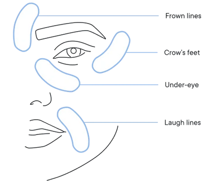 Micro-Infusion Targeted Patches | Early Access Black Friday Sale