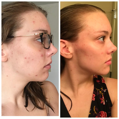 Kojic Acid Turmeric Night Wrapping Mask | Early Access Black Friday Sale